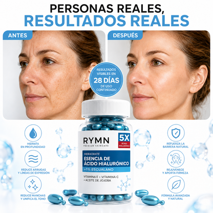 Tratamiento Antiedad RYMN 5X — Ácido Hialurónico